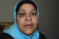  بالفيديو: لقاء مع السيدة زينب مراحلة بعد الاعتداء عليها بالضرب في مستشفى "كبلان"